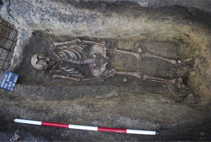   Lenka Vargova et al. / International Journal of Paleopathology, 2022