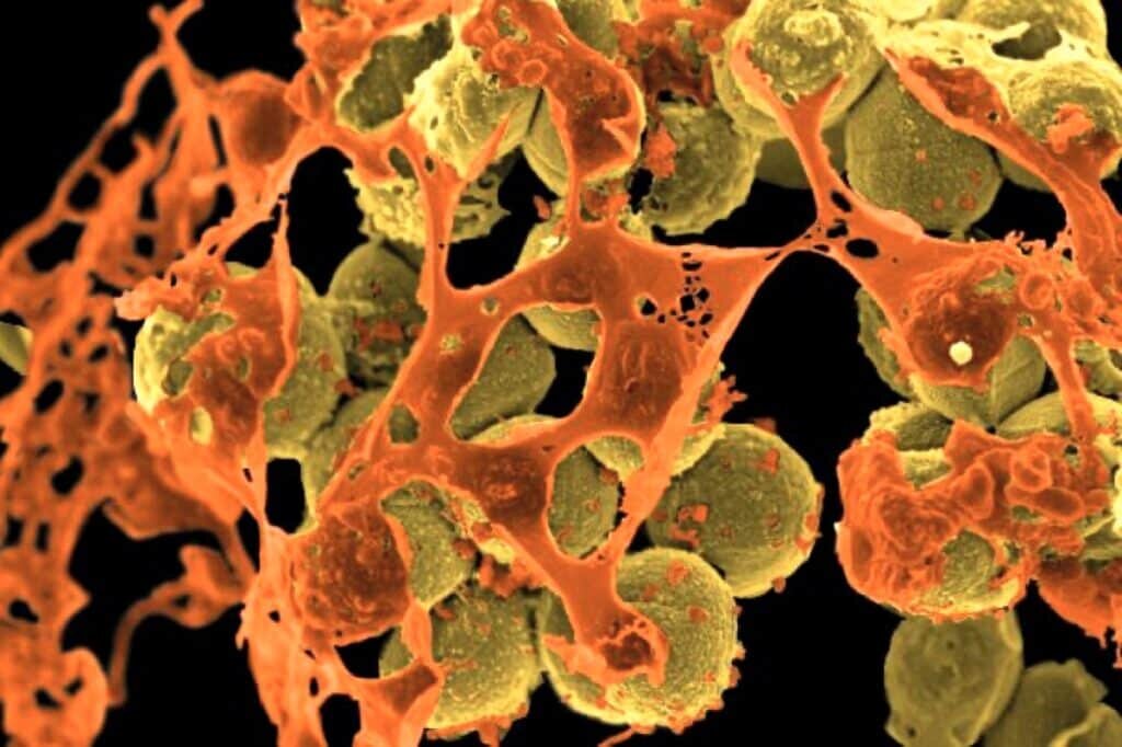    Округлые кокки метициллин-резистентных S. aureus среди остатков разрушенных клеток / ©NIAID