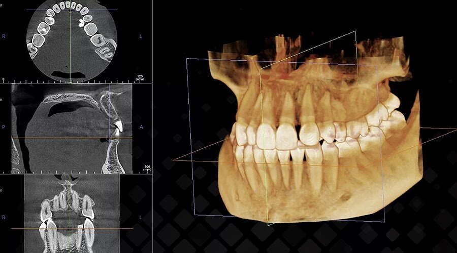 Компьютерная томография позволяет рассмотреть строение любого элемента вашей челюстной системы буквально по слоям. Фото: Яндекс.Картинки.