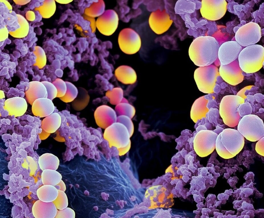 Они являются частью нашей микрофлоры, но всё так же опасны. 