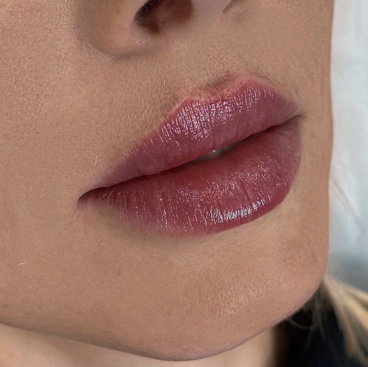 Сочные губы после контурной пластики.