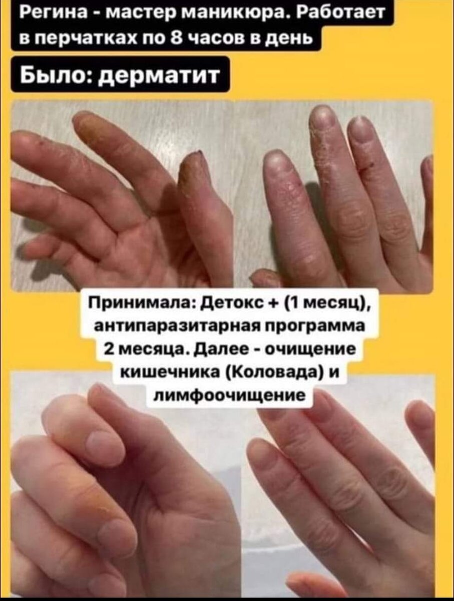 #похудетьлегко 