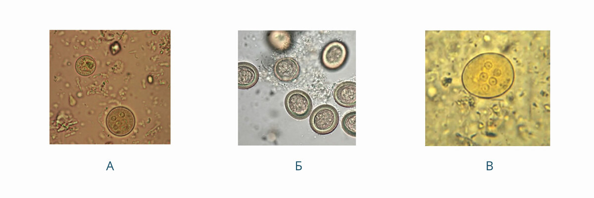 Яйца гельминтов и простейшие в кале. Яйца и цисты гельминтов. Цисты простейших. Цисты простейших в Кале фото.