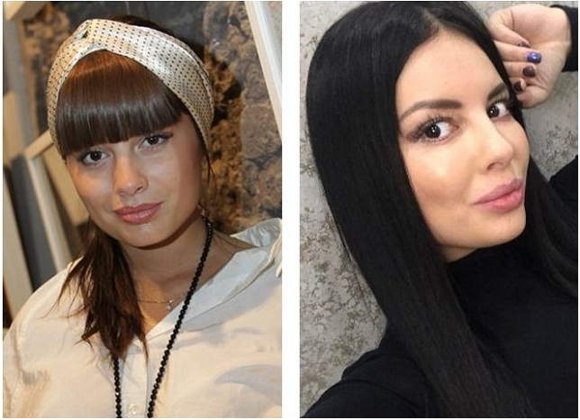 Участницы ДОМ 2 до и после пластических операций (часть 2) Все о дом 2 Дзен