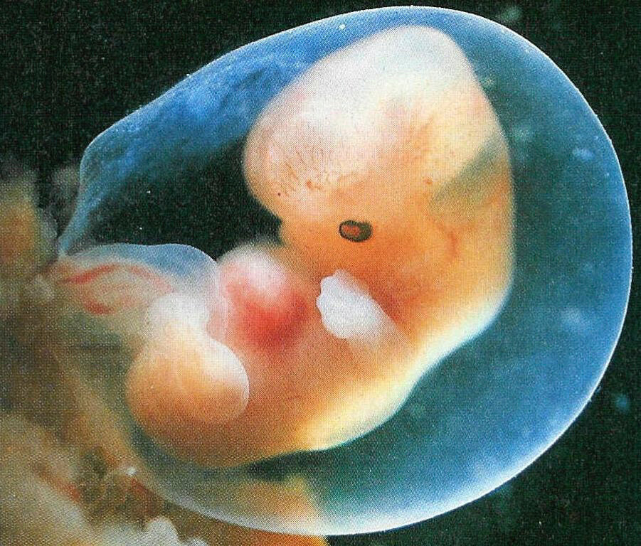 6 недель какой плод. Эмбрион на 7 неделе беременности. Эмбрион на 4-5 неделе беременности. Беременность 7 недель выглядит эмбрион. Зародыш на 7 неделе беременности