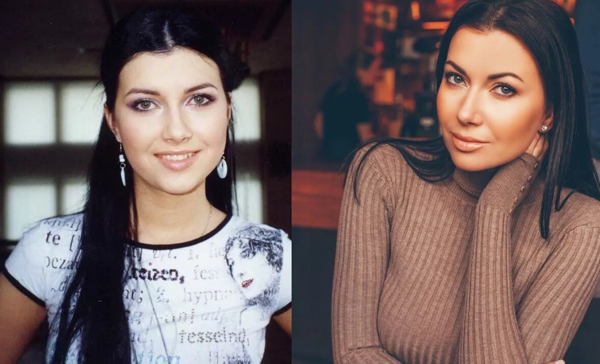 Мария бархударова фото до и после пластики