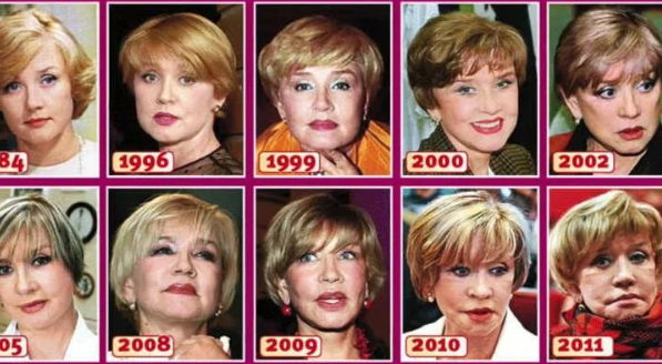 Так менялось лицо Веры Алентовой после множества пластических операций. Источник: Яндекс-картинки.