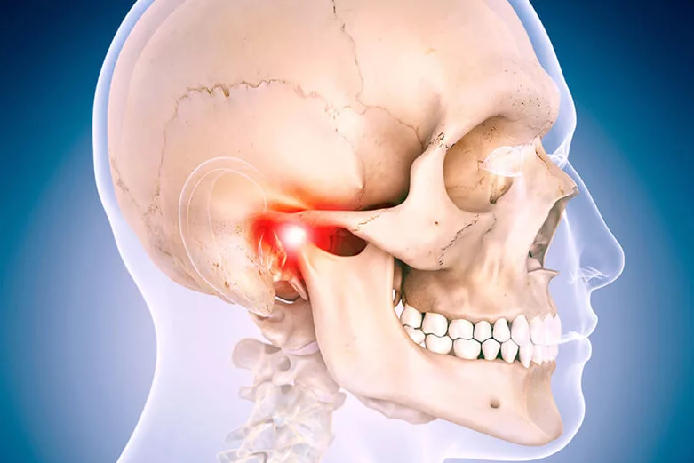 Пациенту может быть прописано ношение специально изготовленной по его слепкам капы или шины