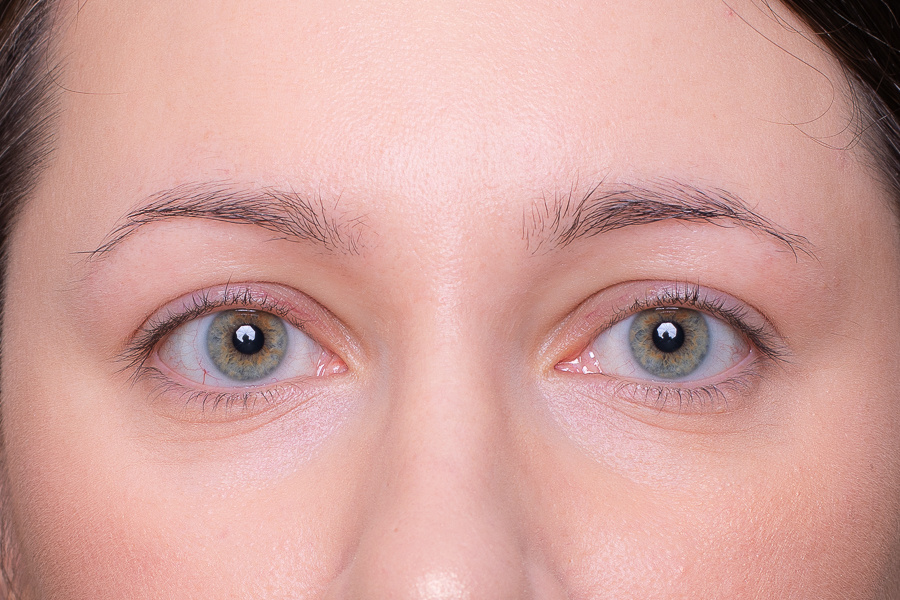 Неправильная форма бровей 