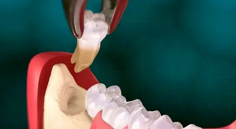 Сколько заживает зуб после удаления