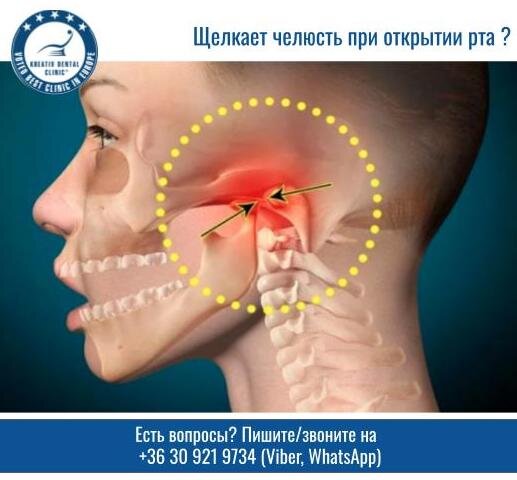 Что делать, если щелкает челюсть?