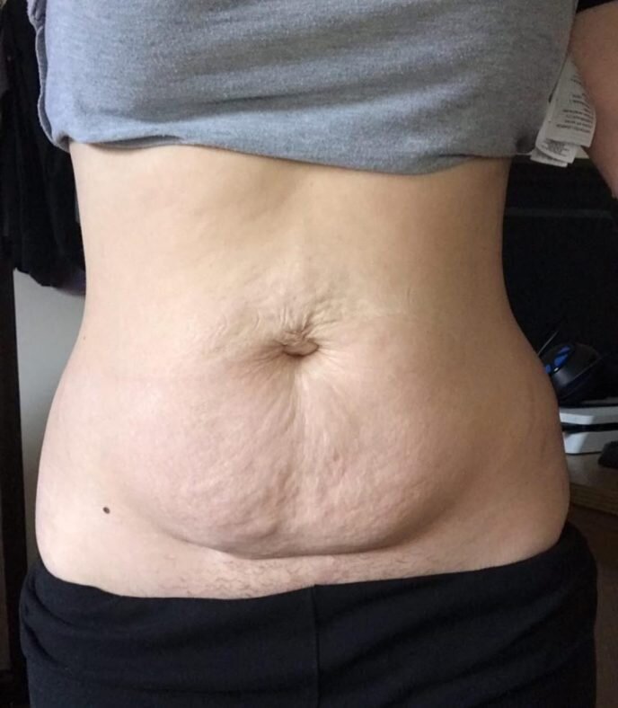 Живот после беременности