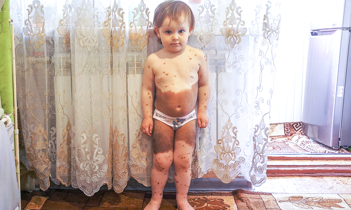 Вероника Янковая, маленькая подопечная фонда "Алёша"