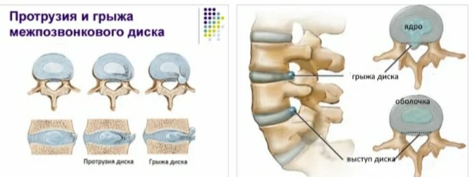 Урчание в животе: причины появления, симптомы и лечение - FitoMarket