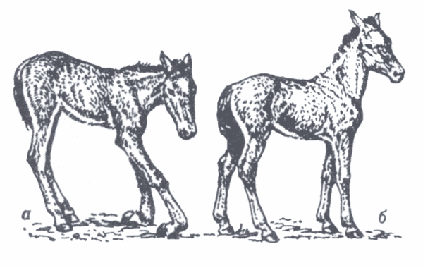 Фото взял из свободных источников. Мне очень понравилось это изображение: наглядно показывает вариант контрактуры.