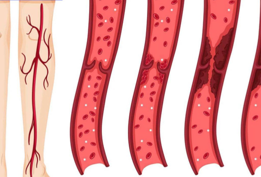 ФОТО: sciencedirect.com