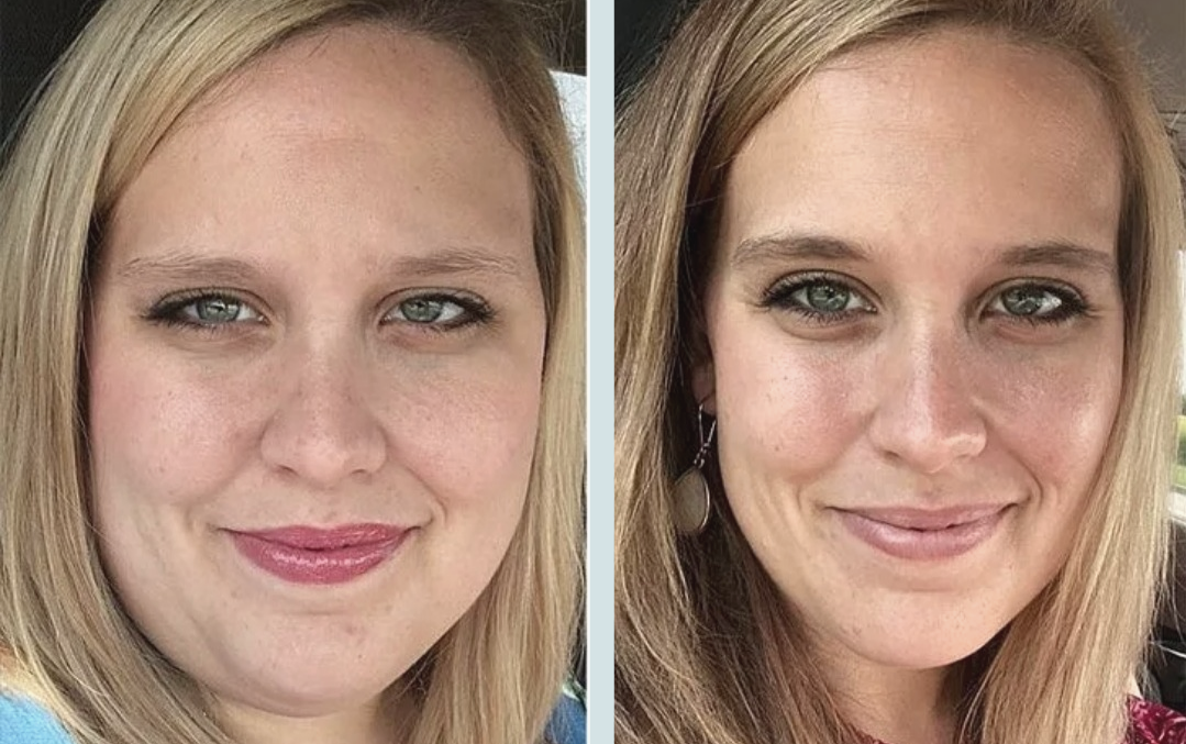 Как люди становятся девушки. Толстое лицо до и после. Лицо до и после похудения. Лица людей до и после похудения. Изменение лица после похудения.