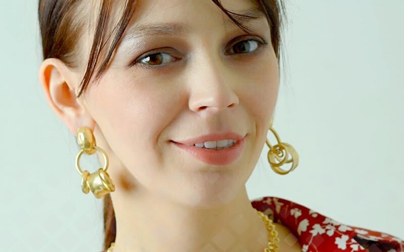 Светлана в подробностях рассказала о своей жизни до и после имплантации и качественного протезирования. Фото:  Из личного архива Светланы.