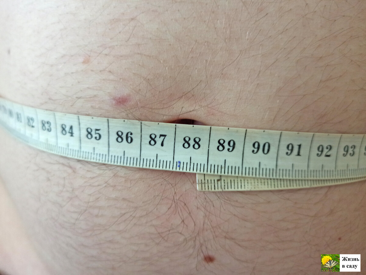 живот 87,5 см