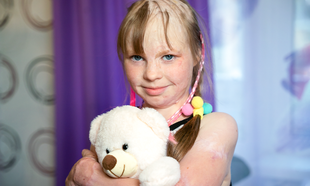 Алеся Петракова, подопечная фонда "Алёша"