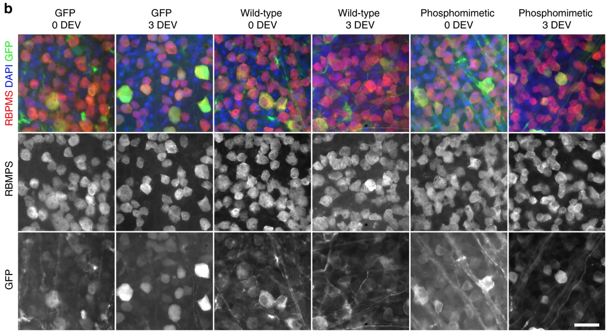 Оценка количества протрудина в экспланте сетчатки. 
Petrova V. et al. / Nature Communications, 2020