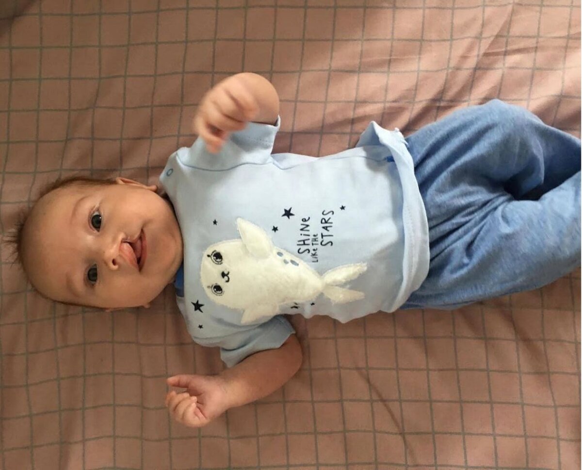 Дима до операции