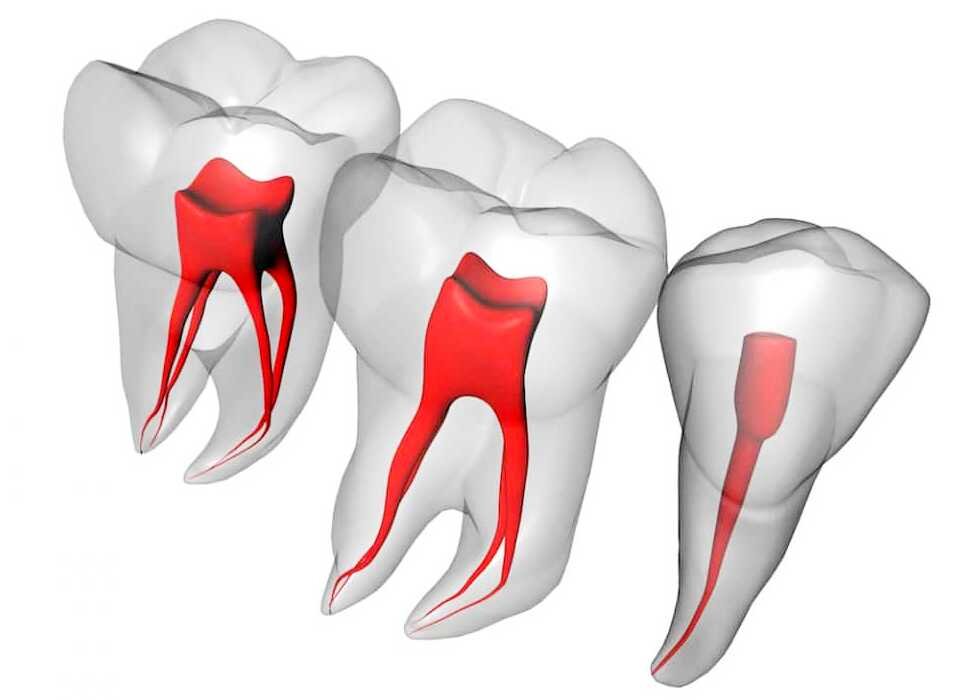 Пульсирующая боль в зубе: причины, как избавиться