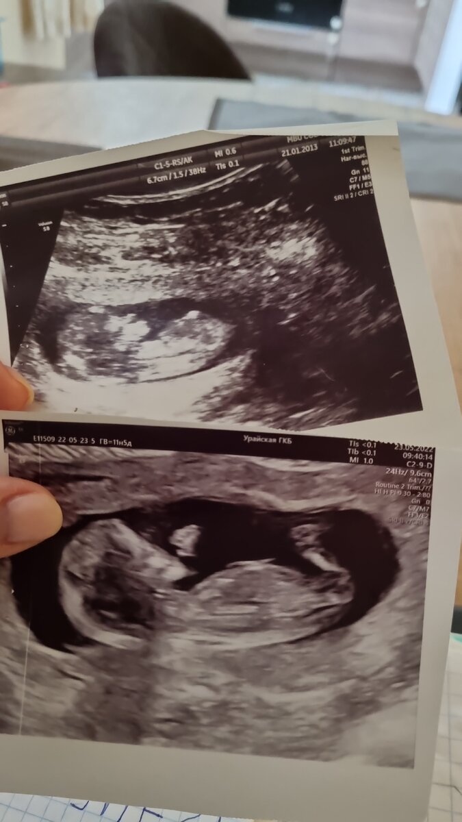 Храню фотографии с УЗИ, как память о своих беременностях ❤️
