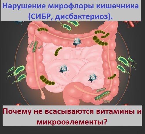 Синдром избыточного роста бактерий - описание, симптомы, диагностика и лечение в СПб