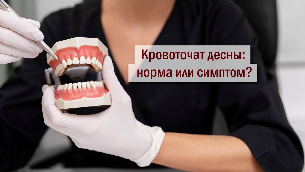 Кровоточат дёсны: причины, лечение и осложнения