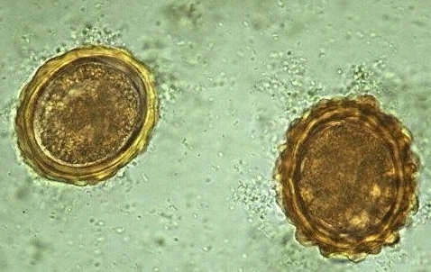 Яйца аскарид - без микроскопа не видны.