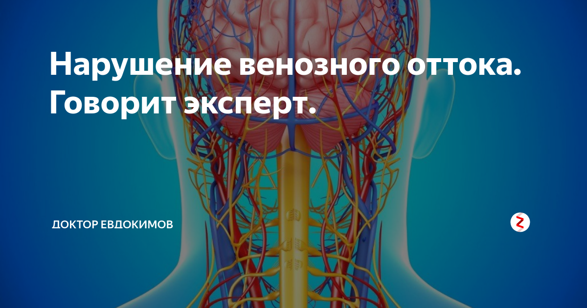 Нарушение венозного оттока ребенок. Нарушение венозного оттока. Нарушение венозного оттока головы.