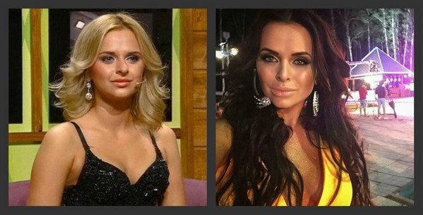 Вика Романец до и после пластических операций, фото: Виктория Романец (@_viktoriya_14)