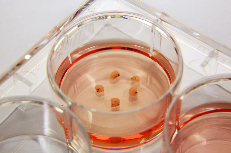 Трехмерные органоиды в чашке Петри \\ Genome Institute of Singapore