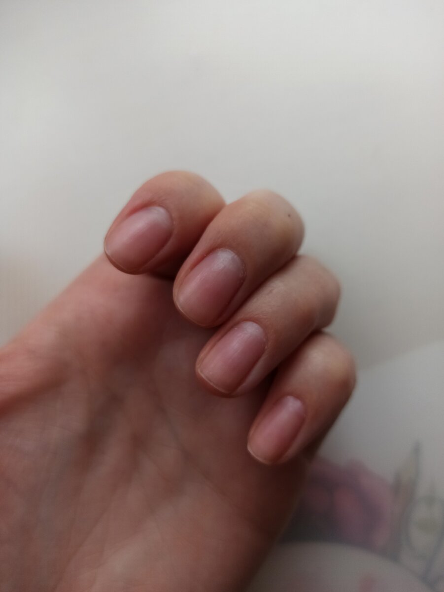 Фото моей руки