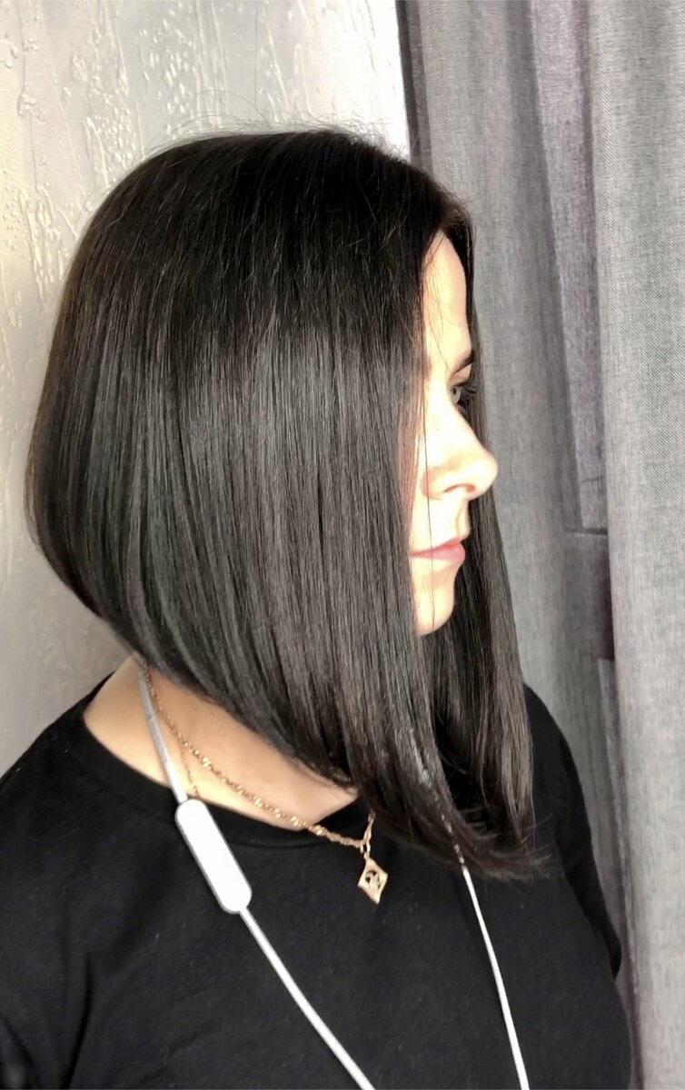 Наращивание височной зоны. Как Вам результат?