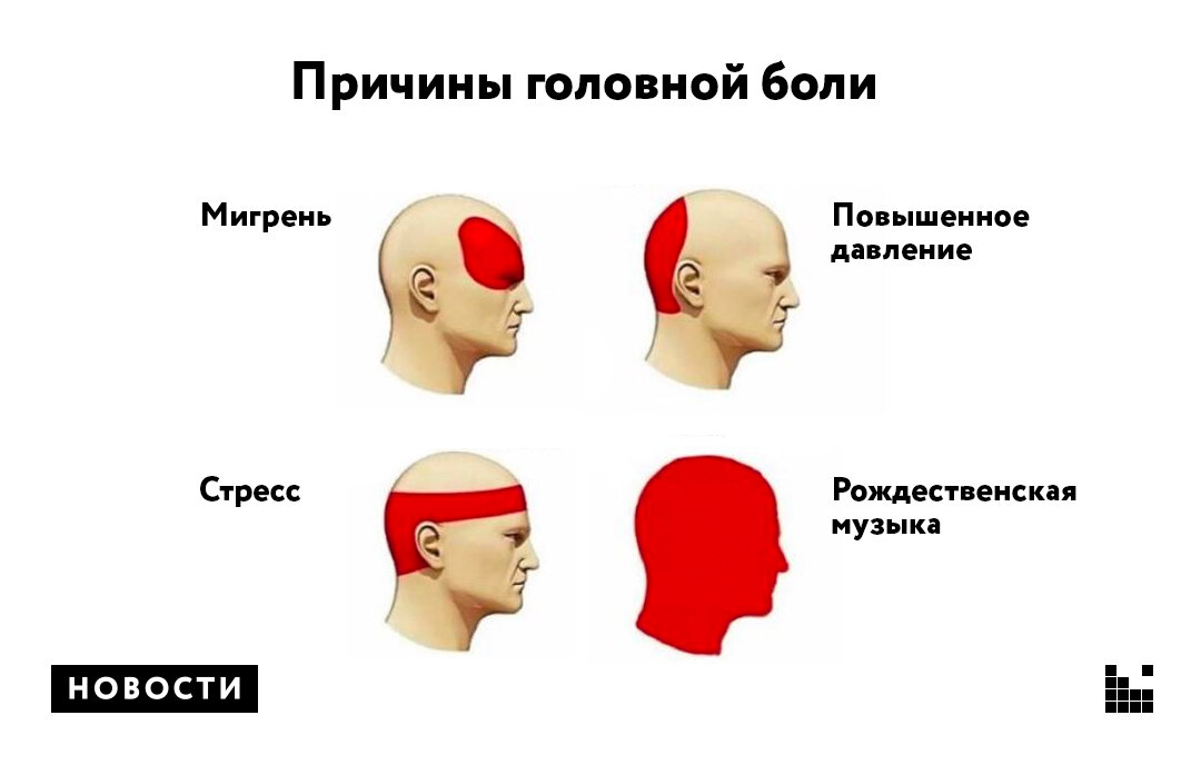 Виды головных болей в картинках