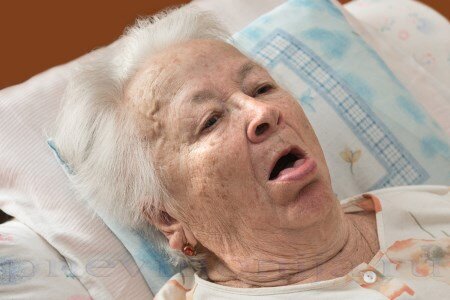  Кашель после инсульта