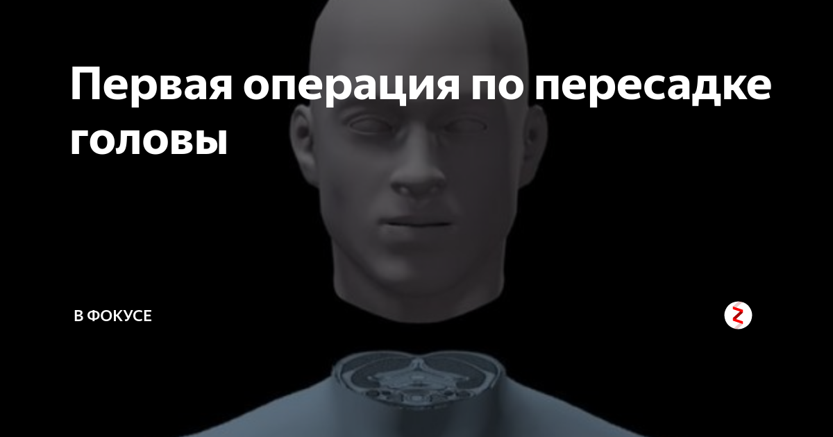 Первая операция по пересадке головы | В ФОКУСЕ | Дзен
