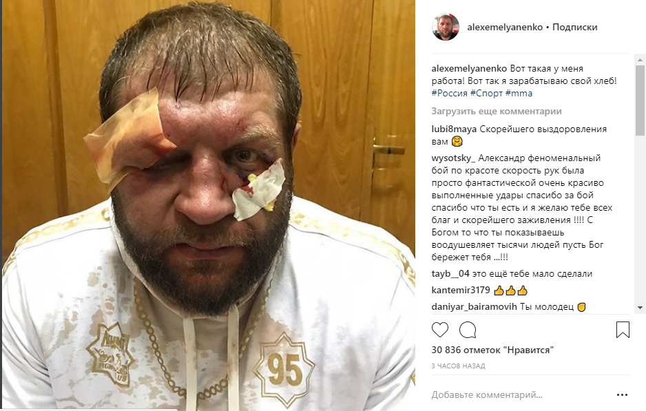 Порядка 8 потрясений было совершено с каждой стороны, после каждого из них, соперник мог произвести серию добиваний, однако бойцы оказались невероятно подготовленными и выносливыми. После поединка Александр поделился фотографией в своем инстаграм, где показал последствия боя.  Александра сразу после боя увезли на скорой, но как оказалось данные меры были излишними, не обнаружилось серьезных повреждений. Говоря о проведении боя-реванша, еще не озвучиваются никаких данных, будем следить за новостями и оповещать Вас! Пожелаем Александру скорейшего выздоровления и возвращения на ринг!
