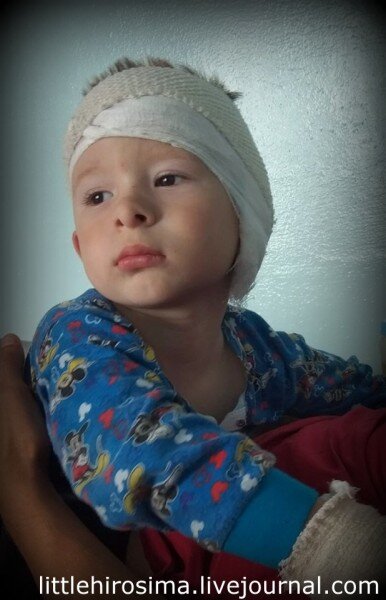 Родин после операции не левое ухо.

