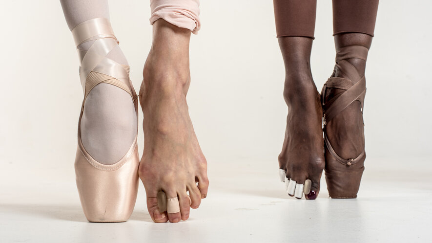 Халюс вальгус - болезнь не только балерин