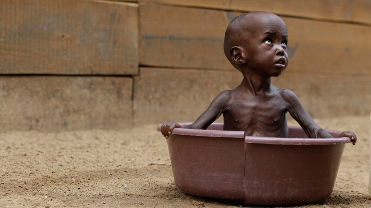 Африка дети без воды и еды. Африканские дети Голодные.