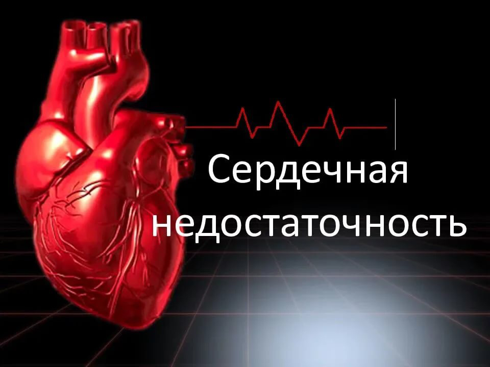 Сердечная недостаточность. Сесердечная недостаточность это. Хроническая сердечная недост. Острая хроническая недостаточность сердца.