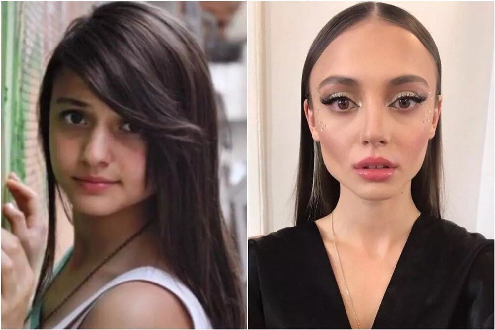 Рабиа сойтюрк гюльпери. Эким до пластики. Кэти топурия до пластики носа. Эка влюбись если. Рабиа сойтюрк актриса.