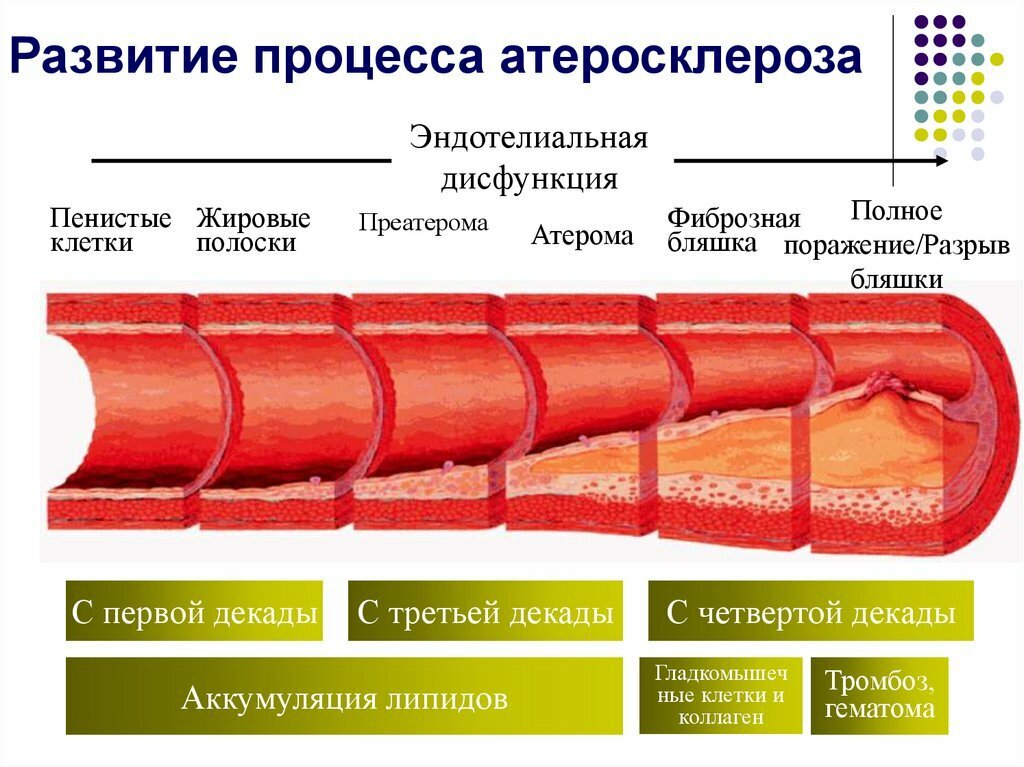 Причина 18