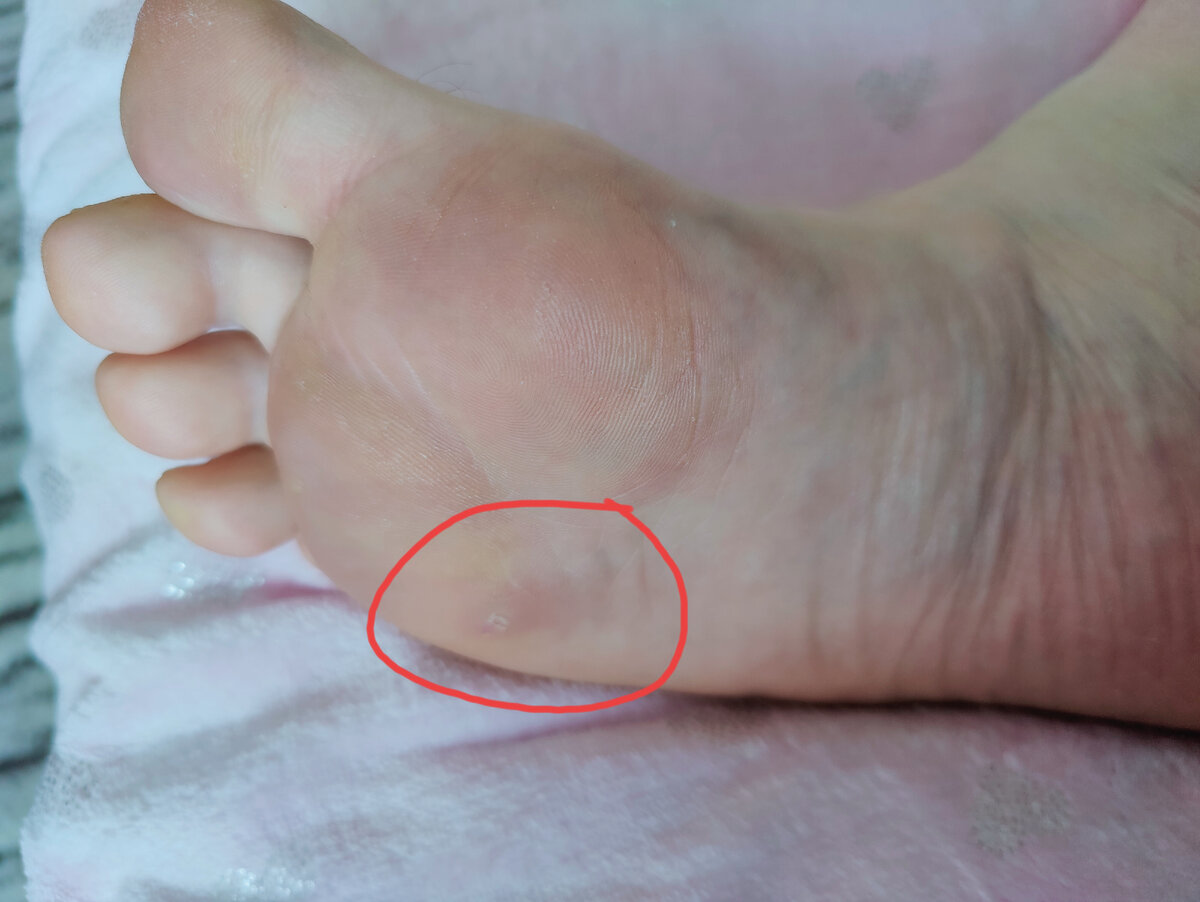 Ужаленная зубочисткой😂