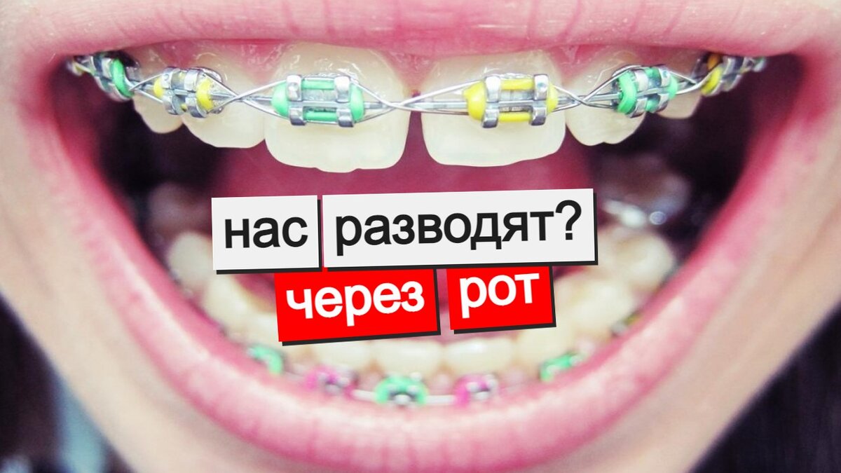 Я тоже хочу брекеты!