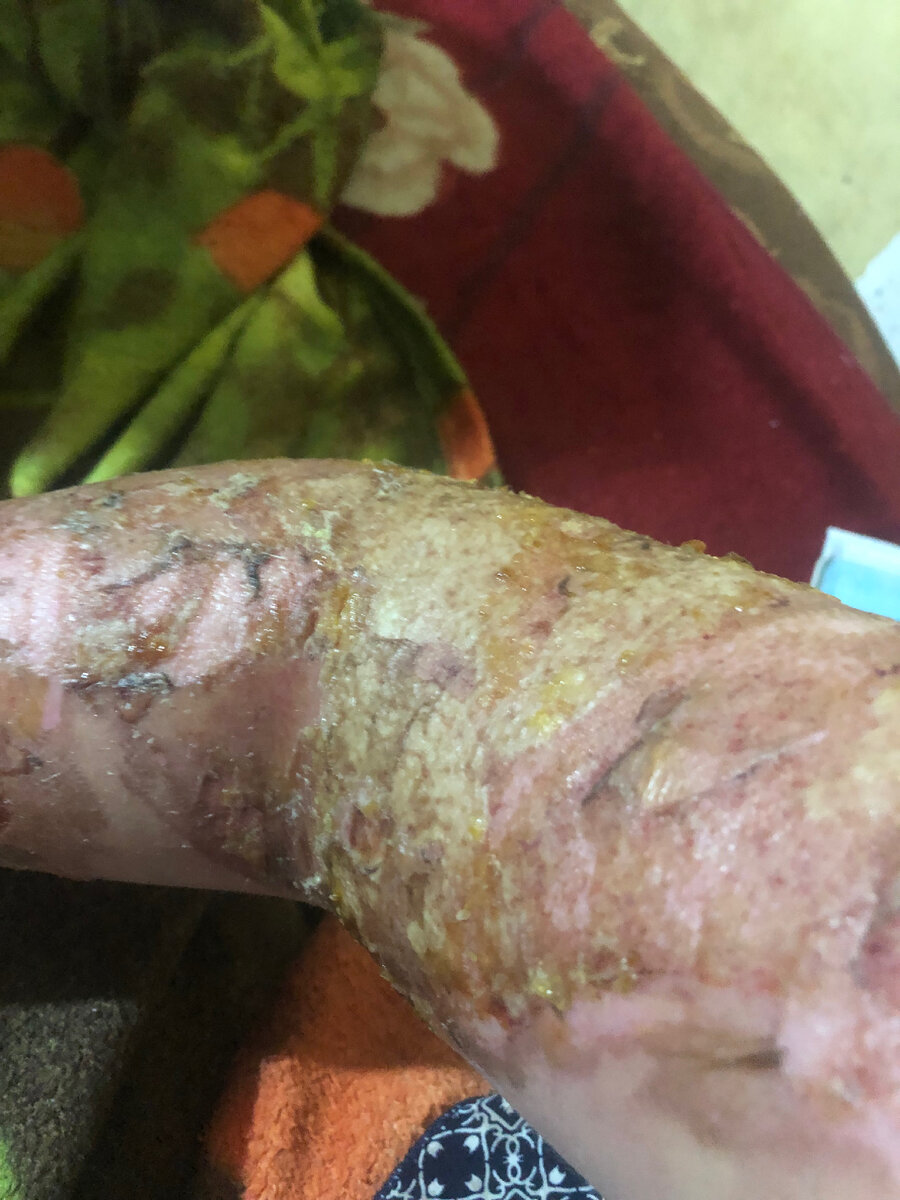 Тут когда ещё лечили меня врачи! 