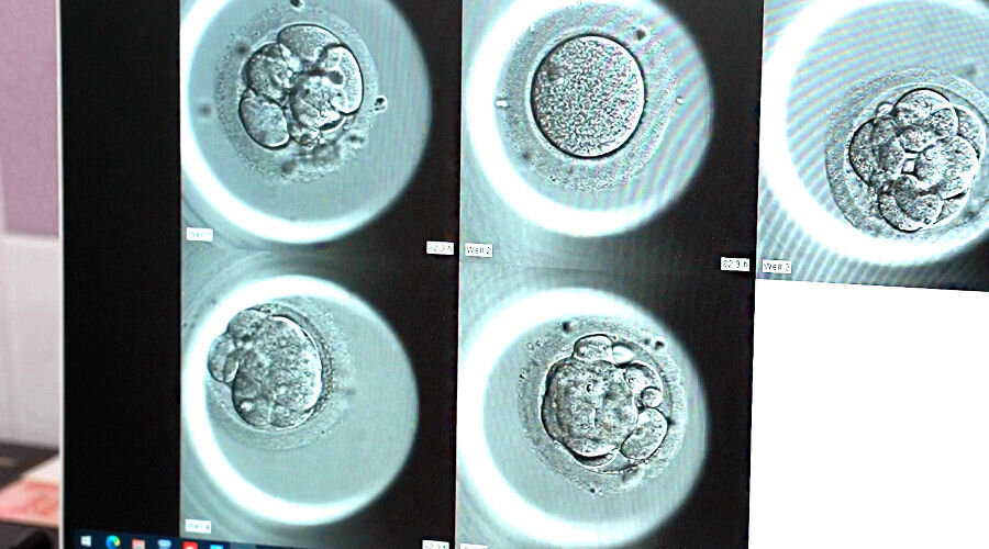 этапы формирования эмбриона. внутриутробная инфекция передающаяся половым путем. узи признаки неразвивающейся беременности. почему эмбрионы останавливаются. неразвивающаяся (замершая) беременность.
